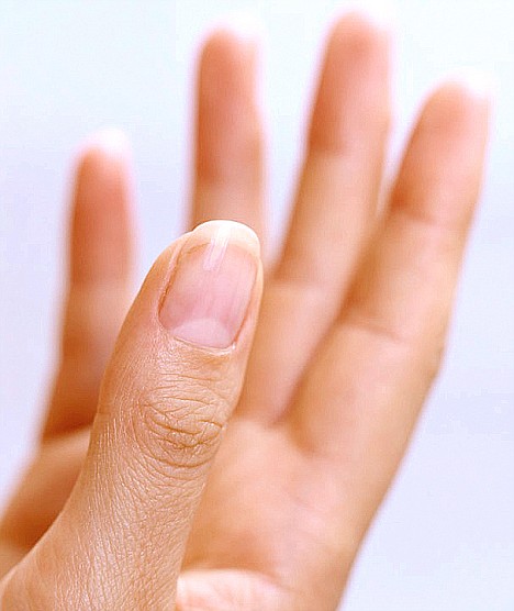 Finger Nails – why there is a white moon ? – Tarra Acupuncture